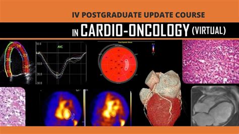 Post Graduate Course Update In Cardio Oncology Ccul