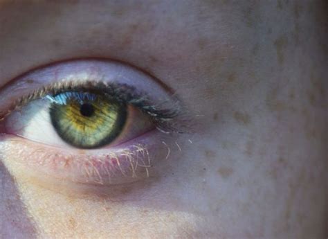 Pale Green Yellow Eye With Central Heterochromia Rare Eyes Eye