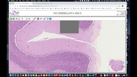 Cerebellum Histology Youtube