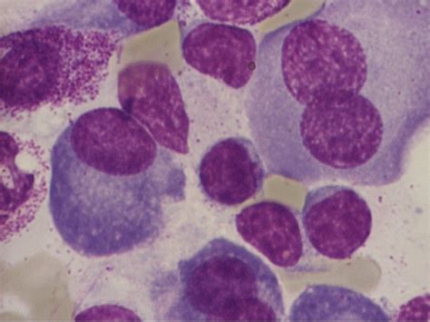 Typical Plasma Cells Nucleus Displaced From The Center Open I