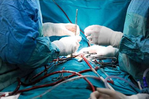 Como é Feita A Cirurgia De Sopro No Coração Cirurgia Do Coração