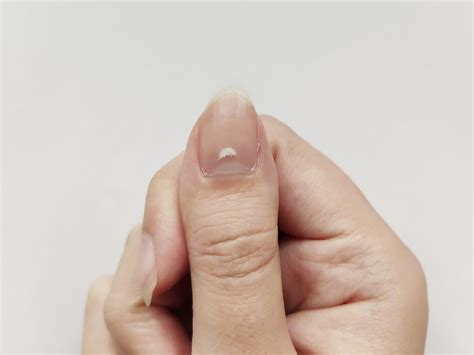 Heres What The White Spots On Your Nails Mean Readers Digest