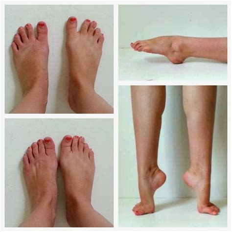 Learning Your Foot Type For The Best Pointe Fit Ballet