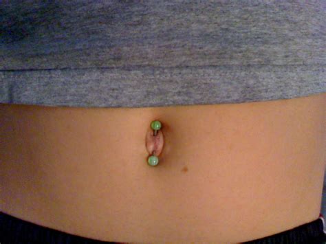 Gross Outie Belly Button