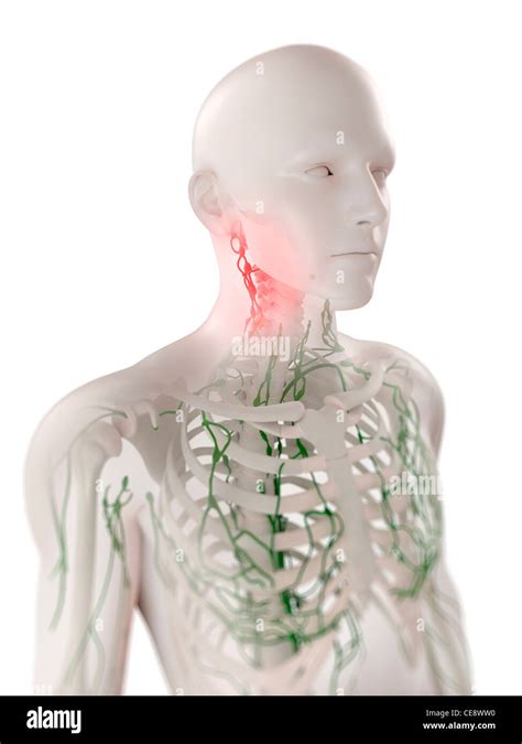 Swollen Lymph Nodes In The Neck Computer Artwork Stock Photo Alamy