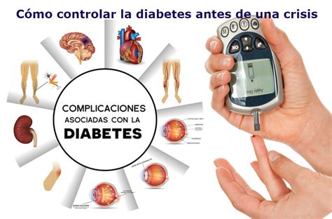 Cuestiones A Tener En Cuenta En El Manejo De La Diabetes En El Adulto