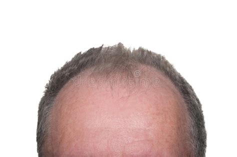 Men Showing Bald Head Stock Photos Free And Royalty Free Stock Photos