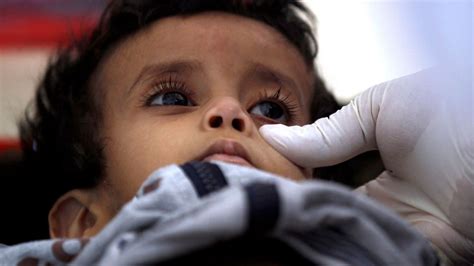 Yemen Cholera Cases Pass 100000 Amid Unprecedented Epidemic Bbc News