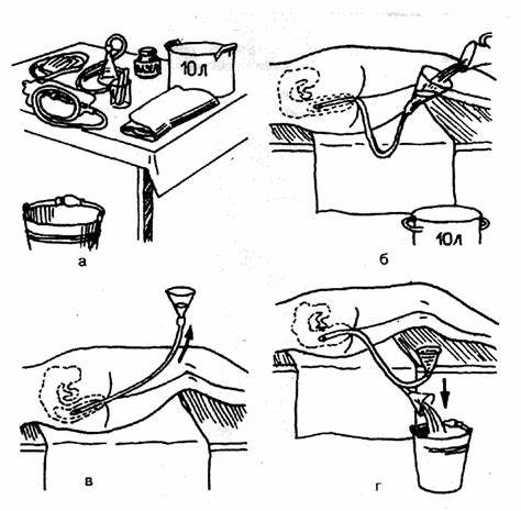 Клизма и диета