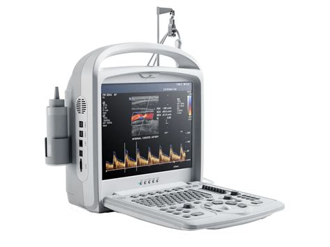 Portable Echography Fetal Doppler 2d3d Ultrasound Diagnostic