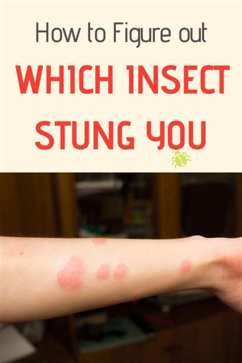 How To Figure Out Which Insect Stung You