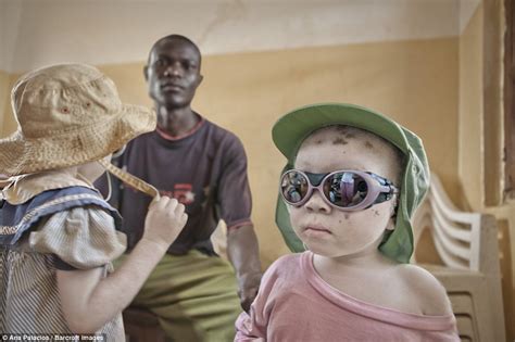 Rescue ‘fortress In Tanzania Protects Albinos From Human Hunters