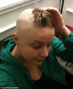 Gail Porter Shaves Her Head After Alopecia Returns Daily Mail Online