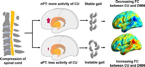 Frontiers Remodeling Of The Brain Correlates With Gait Instability In