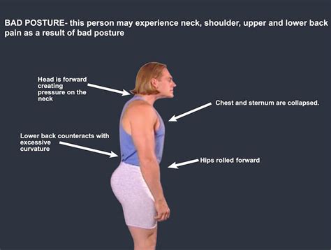 Good Posture Vs Bad Posture