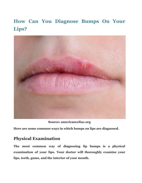 Ppt Bump On Lip Check Out The Causes And Its Treatment Powerpoint Presentation Id11400451