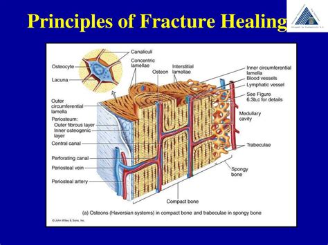 Ppt Principles Of Fracture Healing Powerpoint Presentation Free