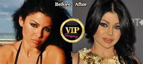 Haifa Wehbe Plastic Surgery Before And After Photos