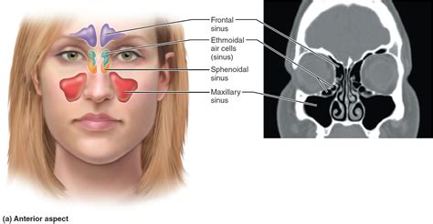 Are Paranasal Sinuses Located In Zygomatic Bones