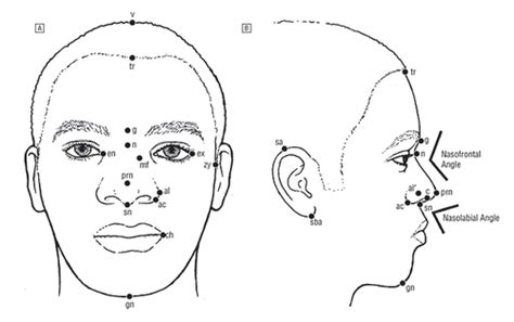 The Average African American Male Face An Anthropometric Analysis Archives Of Facial Plastic