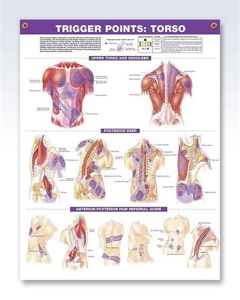 Trigger Points Anatomy Poster With 2 Grommets Trigger Points Medical