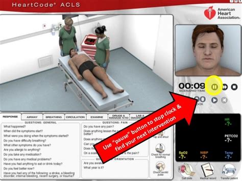 Tips For Heartcode Acls