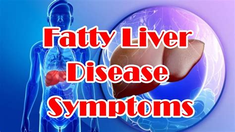 Fatty Liver Symptoms Sign Of Fatty Liver Disease Youtube