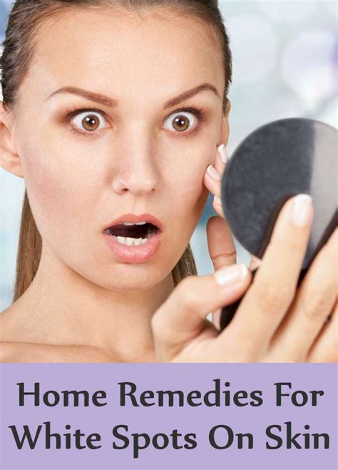 Home Remedies To Get Rid Of White Spots On Face Spots On Face Skin