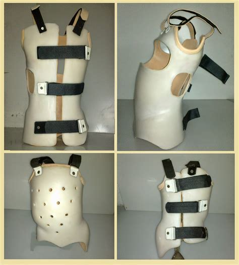 Prosthetics And Orthotics From My Care April 2014