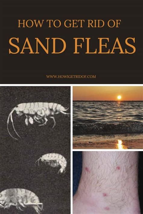 How To Get Rid Of Sand Fleas How I Get Rid Of