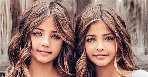 Two Sisters That Were Called The Most Beautiful Twins In The World Are