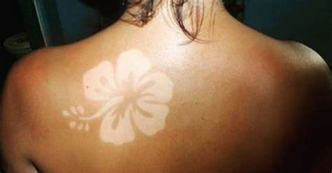 Sunburn Art Or Tan Tattoos Is The Most Dangerous Trend Yet
