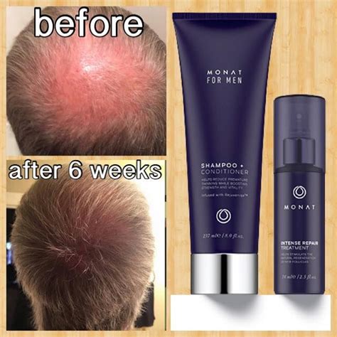 Six Weeks Of Using Monat Global Men S Line Monat Hair Hair Growth For Men Monat