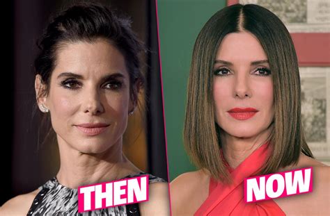 Sandra Bullock Frozen Face Result Of Fillers And Botox Overload Docs Claim