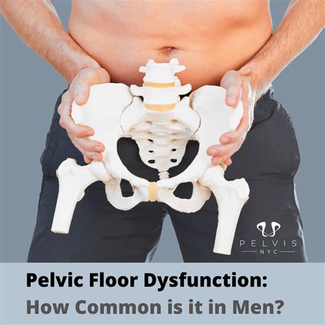 Pelvic Floor Dysfunction How Common Is It In Men Pelvisnyc
