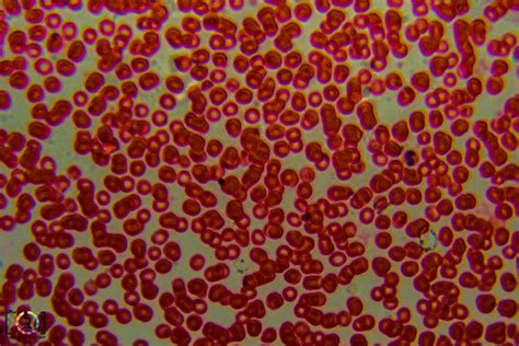 Under The Microscope Red Blood Cells • Travis Hale Photography And