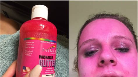 Photo Of Girl Who Accidentally Dyed Her Face Pink Goes Viral Allure
