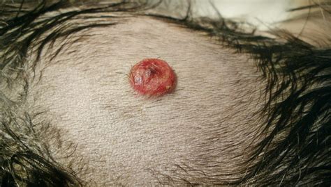 Bladder cancer in dogs can be somewhat tricky to diagnose since the most common symptoms of the disease mimic those of other urinary tract conditions such as stones or infections. Hemangiosarcoma in Dogs: Everything Dog Owners Should Know