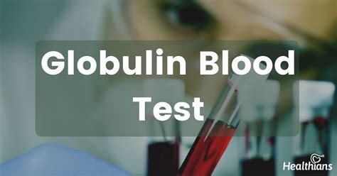 Globulin Test Normal Range High And Low Levels Healthians Blog