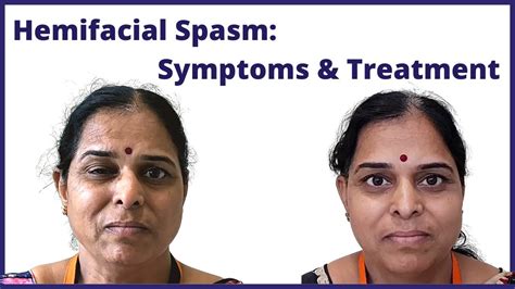 Hemifacial Spasms Symptoms And Treatment Dr Jaydev Panchwagh Youtube