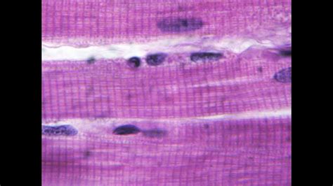 Skeletal Muscle Tissue Under Microscope Labeled Micropedia