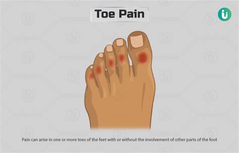 Toe Pain Symptoms Causes Treatment Doctor Medicine Prevention