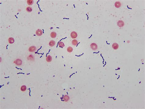 Streptococcus Agalactiae Gram Stain
