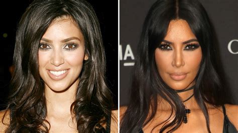 Kim Kardashian Denies Nose Job Updated