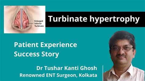 Inferior Turbinate Hypertrophy Treatment In Kolkata Patient Experience