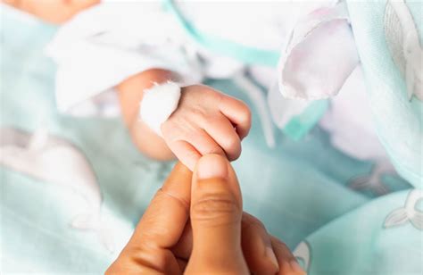 ¿cómo Cuidar A Un Bebé Prematuro
