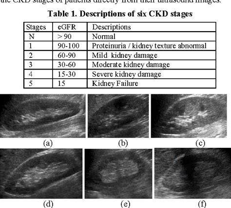 Not specific for renal function. Table 1 from Stage Classification in Chronic Kidney Disease by Ultrasound Image | Semantic Scholar