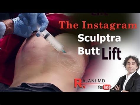 Butt Lift With Sculptra Instagram Take Dr Rajani Youtube
