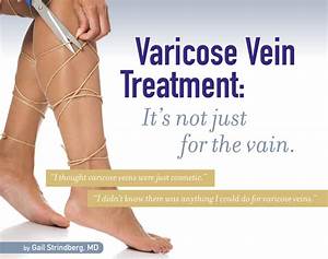 Varicose Vein Treatment - Northpointe Medical  Heart and Circulation Varicose Veins