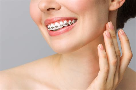 Orthodontic Treatment Singapore Dental Braces Clinic